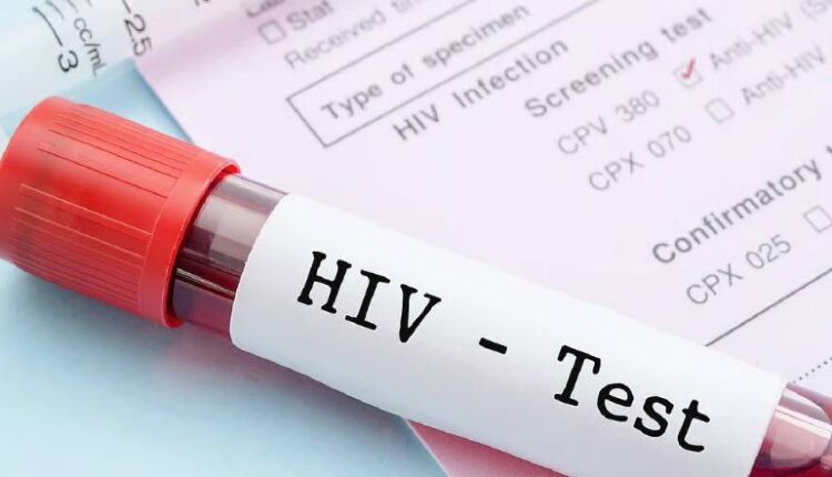অসমে বাড়ছে HIV আক্রান্তের সংখ্যা